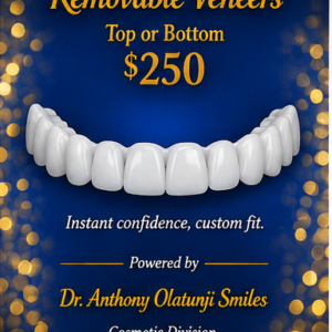 Removable Veneers (Top OR Bottom)