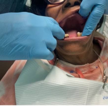 Before Eearlene V – complete upper and lower extractions with EXT and BF Before Eearlene V - complete upper and lower extractions with EXT and BF